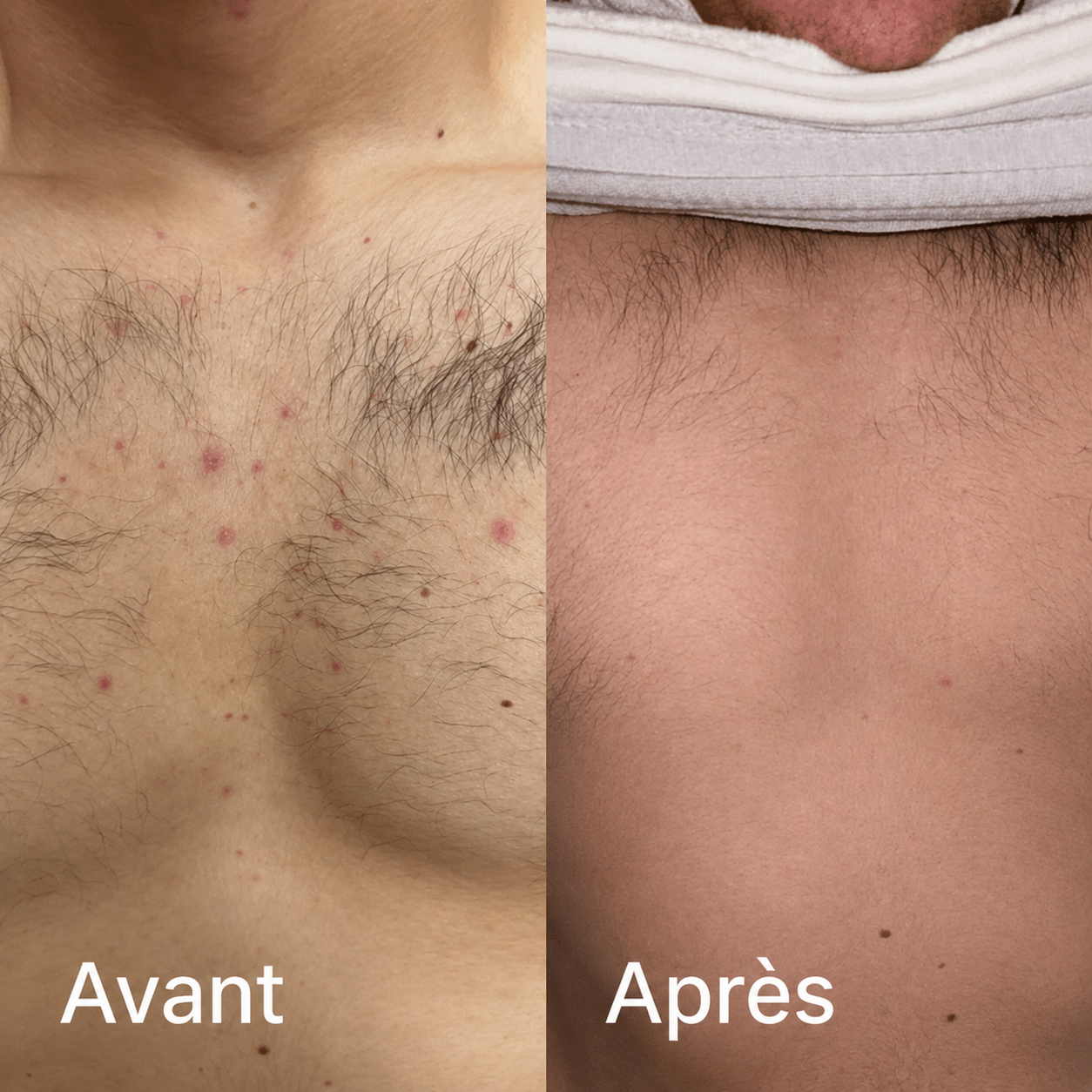 Image avant et après